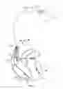 Fig. 17 - Systems and methods for implanting a medical device