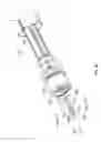 Fig. 06 - Implantable medical device having restrained tether device