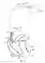 Fig. 13 - Implantable medical device having restrained tether device