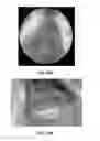 Fig. 14 - Apparatus and methods relating to intravascular positioning of distal end of catheter
