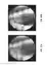 Fig. 15 - Apparatus and methods relating to intravascular positioning of distal end of catheter