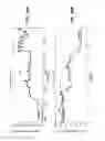 Fig. 16 - Apparatus and methods relating to intravascular positioning of distal end of catheter