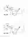 Fig. 20 - Apparatus and methods relating to intravascular positioning of distal end of catheter