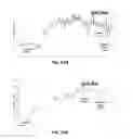 Fig. 25 - Apparatus and methods relating to intravascular positioning of distal end of catheter