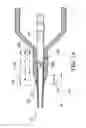 Fig. 09 - Balloon catheter