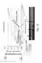 Fig. 10 - Balloon catheter