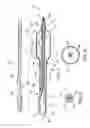 Fig. 02 - Balloon catheter