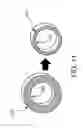 Fig. 07 - Balloon catheter