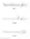 Fig. 02 - Balloon catheter