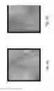 Fig. 03 - Balloon catheter