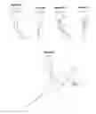 Fig. 04 - Methods and apparatuses for coating balloon catheters