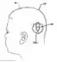Fig. 01 - Methods and devices for locating and adjusting an implantable valve