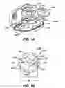 Fig. 02 - Methods and devices for locating and adjusting an implantable valve