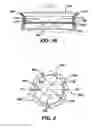 Fig. 04 - Methods and devices for locating and adjusting an implantable valve