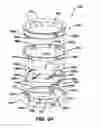 Fig. 05 - Methods and devices for locating and adjusting an implantable valve