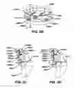 Fig. 10 - Methods and devices for locating and adjusting an implantable valve