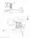 Fig. 12 - SYSTEMS, METHODS, AND DEVICES ADDRESSING THE GASTRO-INTESTINAL TRACT