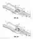 Fig. 04 - CATHETER ADAPTER APPARATUS
