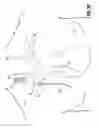 Fig. 11 - CATHETER ADAPTER APPARATUS