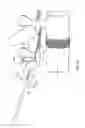 Fig. 07 - Systems and methods for implanting electrode leads for use with implantable neuromuscular electrical stimulator