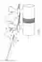 Fig. 09 - Systems and methods for implanting electrode leads for use with implantable neuromuscular electrical stimulator