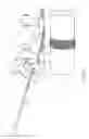Fig. 11 - Systems and methods for implanting electrode leads for use with implantable neuromuscular electrical stimulator