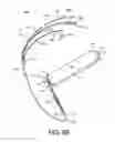 Fig. 13 - Cardiac pacing lead delivery system