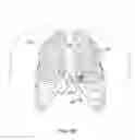 Fig. 06 - Delivery system for cardiac pacing