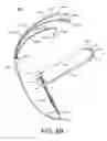 Fig. 13 - Delivery system for cardiac pacing
