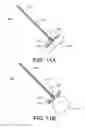 Fig. 16 - Delivery system for cardiac pacing