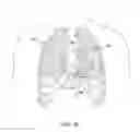 Fig. 05 - Cardiac pacing