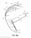 Fig. 13 - Cardiac pacing
