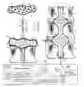 Fig. 01 - System and methods for diagnosis and treatment of discogenic lower back pain