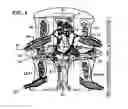 Fig. 05 - System and methods for diagnosis and treatment of discogenic lower back pain