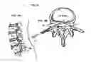 Fig. 07 - System and methods for diagnosis and treatment of discogenic lower back pain