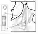 Fig. 01 - Closed-loop vagus nerve stimulation