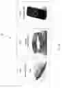 Fig. 03 - Closed-loop vagus nerve stimulation