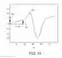 Fig. 14 - DETERMINING ONSETS AND OFFSETS OF CARDIAC DEPOLARIZATION AND REPOLARIZATION WAVES