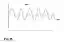 Fig. 26 - Pulse detection using patient physiological signals