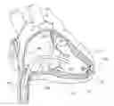 Fig. 01 - Delivery system assemblies for implantable medical devices