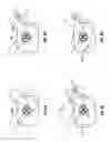 Fig. 05 - METHOD AND APPARATUS FOR ELECTRICAL STIMULATION THERAPY