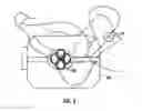 Fig. 07 - METHOD AND APPARATUS FOR ELECTRICAL STIMULATION THERAPY