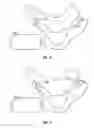 Fig. 09 - METHOD AND APPARATUS FOR ELECTRICAL STIMULATION THERAPY