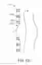 Fig. 12 - METHOD AND APPARATUS FOR ELECTRICAL STIMULATION THERAPY