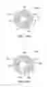 Fig. 15 - METHOD AND APPARATUS FOR ELECTRICAL STIMULATION THERAPY