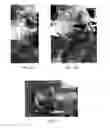 Fig. 18 - TRANSCRANIAL MAGNETIC STIMULATION FOR IMPROVED ANALGESIA