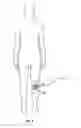 Fig. 03 - METHODS AND DEVICES FOR TREATING MIGRAINES WITH ELECTROMAGNETIC STIMULATION
