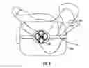 Fig. 07 - METHODS AND DEVICES FOR TREATING MIGRAINES WITH ELECTROMAGNETIC STIMULATION