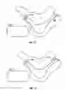 Fig. 09 - METHODS AND DEVICES FOR TREATING MIGRAINES WITH ELECTROMAGNETIC STIMULATION