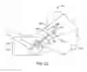 Fig. 16 - METHODS AND DEVICES FOR TREATING MIGRAINES WITH ELECTROMAGNETIC STIMULATION